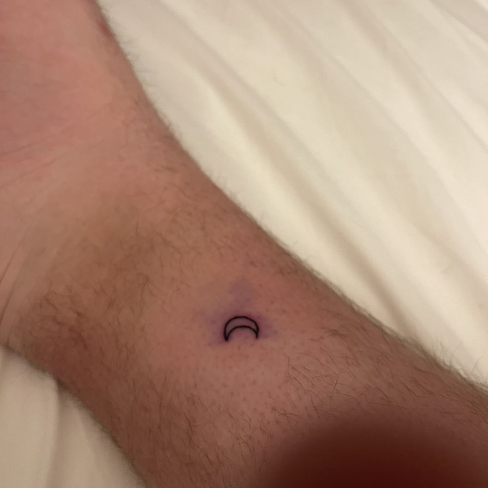 After I removed the bandage