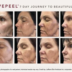 The Best 10 Laser Hair Removal In Seattle Wa Last Updated November 2020 Yelp