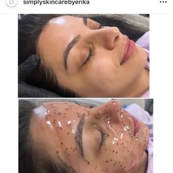 Simply skincare by Erika - Jelly mask