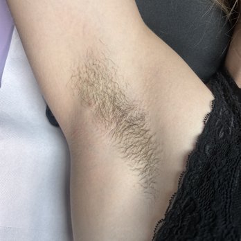 Spellbound Wax and Skin - Underarm wax before - Waxing Near Me - Las Vegas, Nevada Spellbound Wax and Skin - Underarm wax before - Waxing Near Me - Las Vegas, Nevada