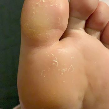 Topline Nails and Lashes - 7 hour pedicure postpartum... wasn't scrubbed correctly - Nail Salons Near Me - Pico Rivera, California Topline Nails and Lashes - 7 hour pedicure postpartum... wasn't scrubbed correctly - Nail Salons Near Me - Pico Rivera, California