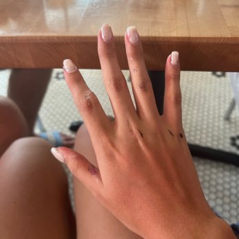 Big Pink - hands red from constant itching and bites - Pizza Near Me - Miami Beach, Florida Big Pink - hands red from constant itching and bites - Pizza Near Me - Miami Beach, Florida