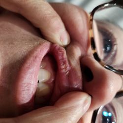 Valley Endodontics & Oral Surgery