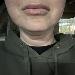 Botanica Beauty - Immediately after.