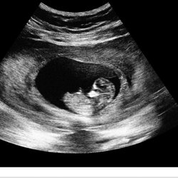 My Baby's First Images