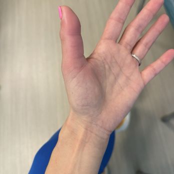 Nails On Cass St - Cellulitis from manicure - Nail Salons Near Me - Monterey, California