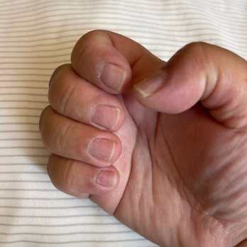 Kitchen Nail Bar - Mountain View - Uneven cut of nails. - Nail Salons Near Me - Mountain View, California