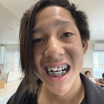 Apex Orthodontics - Orthodontists Near Me - West Covina, California