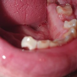 Greenhill Periodontics & Implants