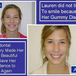 Periodontal Associates of Jackson, P.A - Our Jackson, Mississippi office is here to provide you with a BEAUTIFUL smile. Just like Lauren!