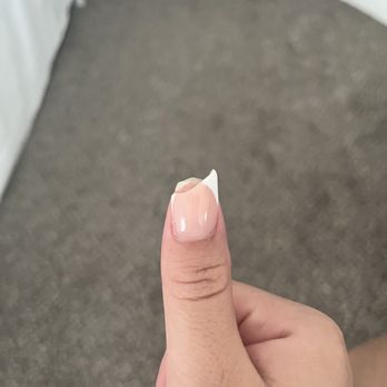 Midtown Nail Lounge - My broken thumb from the water bottle - Nail Salons Near Me - Phoenix, Arizona