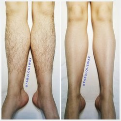 Fabulous Wax and Skincare by Shirley - No more shaving. Waxing to the rescue. Perfect for vacations or if you have coarse leg hairs. Book now!