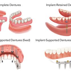 Maryland Sedation Dentist