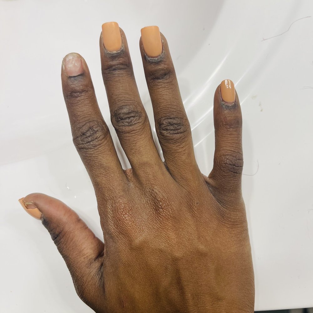 L'Vee Nails Spa - Nails after clipped down, still chipping and breaking. - Day Spas Near Me - Bethesda, Maryland L'Vee Nails Spa - Nails after clipped down, still chipping and breaking. - Day Spas Near Me - Bethesda, Maryland