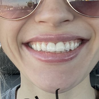 Eagle Pointe Dentists and Orthodontics - Eagle pointe you truly suck! Look how amazing my teeth look now. No thanks to y'all. - General Dentistry Near Me - Albuquerque, New Mexico Eagle Pointe Dentists and Orthodontics - Eagle pointe you truly suck! Look how amazing my teeth look now. No thanks to y'all. - General Dentistry Near Me - Albuquerque, New Mexico