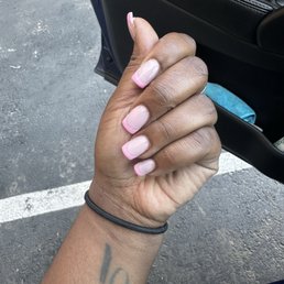The ugly nails