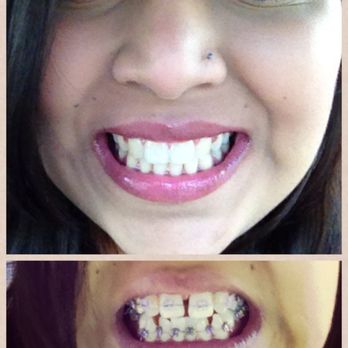 Salins Orthodontics - Orthodontists Near Me - Union City, California