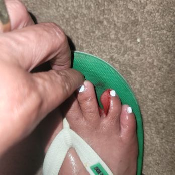Bebe Nails & Spa - Cut and bleeding toe 45 mins after appointment - Nail Salons Near Me - Oakland, California