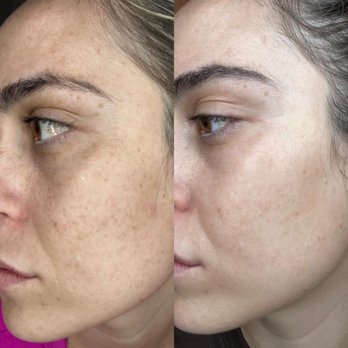 Glo Up By Kara - Estheticians Near Me - Brooklyn, New York Glo Up By Kara - Estheticians Near Me - Brooklyn, New York
