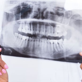 Epler Parke Dentistry - General Dentistry Near Me - Indianapolis, Indiana Epler Parke Dentistry - General Dentistry Near Me - Indianapolis, Indiana