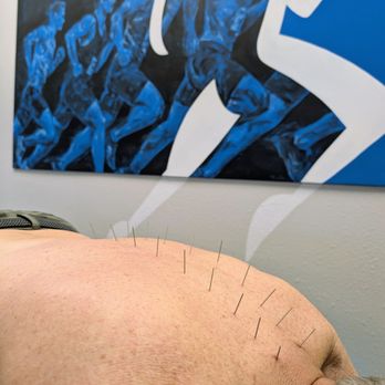 Movewell Physical Therapy & Performance - Dry Needling for back pain. - Physical Therapy Near Me - Phoenix, Arizona Movewell Physical Therapy & Performance - Dry Needling for back pain. - Physical Therapy Near Me - Phoenix, Arizona