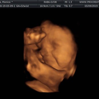 Procreate 4d - Diagnostic Imaging Near Me - Los Angeles, California