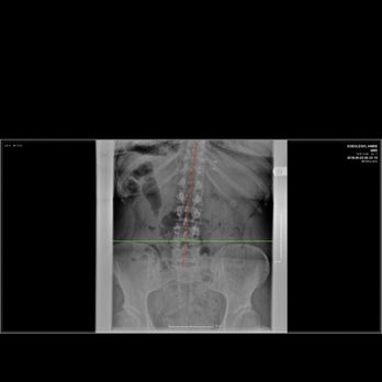 Sunset Hills Chiropractic - Chiropractors Near Me - Saint Louis, Missouri