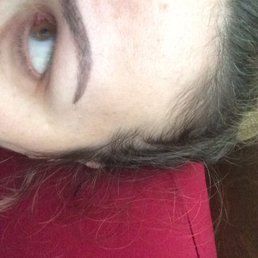 Two weeks after my touch up. Almost healed, and amazing!! Two weeks after my touch up. Almost healed, and amazing!!