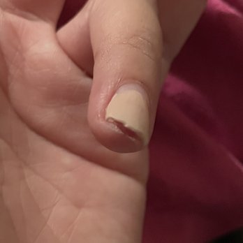 Elegance Nail - 3rd Broken nail - Nail Salons Near Me - Friendswood, Texas