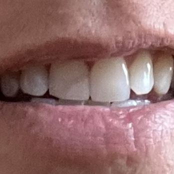Dental Healing Arts - Cosmetic Dentists Near Me - Jupiter, Florida Dental Healing Arts - Cosmetic Dentists Near Me - Jupiter, Florida