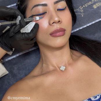 Starlit Aesthetics - Rejuran under-eye injection - Skin Care Near Me - Pasadena, California