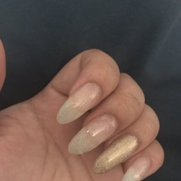 Peeling top coat on middle finger