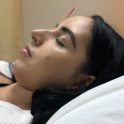 East Lake Acupuncture - This Point is called a Yin Tang. It is used for calming the mind, easing stress, treating sinus headaches & reducing Parkinson's tremors