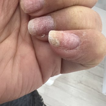 The Nail'ery & Co - What the nail tech considered to be a finished acrylic removal job :/ - Nail Salons Near Me - Glendale, California The Nail'ery & Co - What the nail tech considered to be a finished acrylic removal job :/ - Nail Salons Near Me - Glendale, California