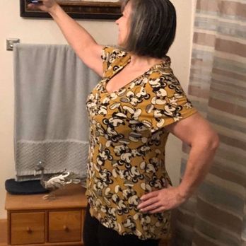 Dr Stile - 17 days post surgery and feeling fabulous! - Cosmetic Surgeons Near Me - Las Vegas, Nevada Dr Stile - 17 days post surgery and feeling fabulous! - Cosmetic Surgeons Near Me - Las Vegas, Nevada