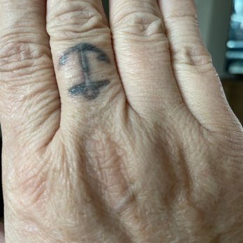 Zapatat - 3 months after 600.00 and 4 sweeps - Tattoo Removal Near Me - Arlington, Virginia