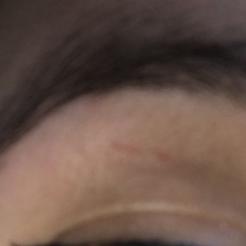 CA Eyebrow Threading - Santa Ana - What it looked like the next day :/ - Threading Services Near Me - Santa Ana, California CA Eyebrow Threading - Santa Ana - What it looked like the next day :/ - Threading Services Near Me - Santa Ana, California