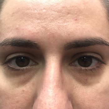 Lash Lift NYC - Before - Eyelash Service Near Me - New York, New York Lash Lift NYC - Before - Eyelash Service Near Me - New York, New York