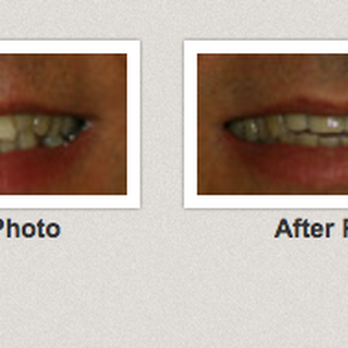 Riverwalk Dental - General Dentistry Near Me - Rolling Meadows, Illinois