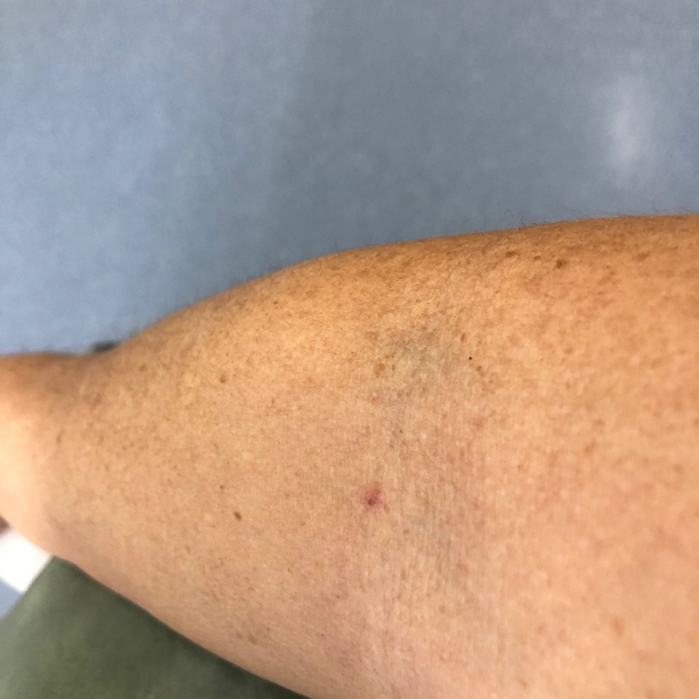 Biolife Plasma Services Tucson, AZ - Last Updated January 2026 - Yelp, image size:1000x1000