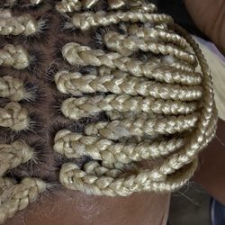 Mama’s Hair Braiding - My poor scalp