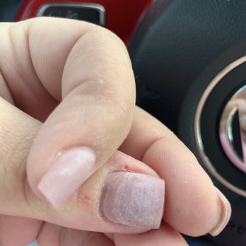 Luxe Nail Bar - Horrible cuticles, cut thumb - Nail Salons Near Me - Bradenton, Florida