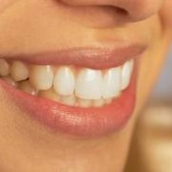 Gainesville Family Dentistry - Sample smiles 2