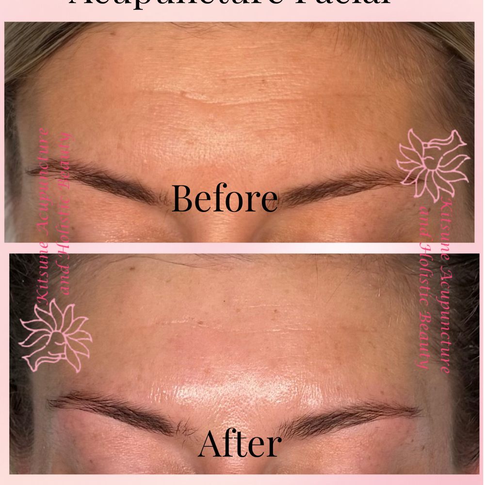 l glutathione injection price in india Glutathione Injection 600 Mg, For Skin Whitening at  319/vial in Nagpur