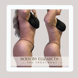 Body By Elizabeth - Congratulations to our amazing post-op clients on their body sculpting journey!