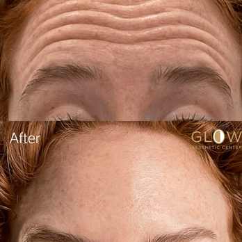 Glow Aesthetic Center - Medical Spas Near Me - Thousand Oaks, California Glow Aesthetic Center - Medical Spas Near Me - Thousand Oaks, California