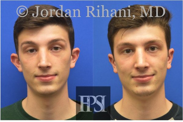 FACIAL PLASTIC SURGERY INSTITUTE - Updated August 2024 - 17 Photos & 10 