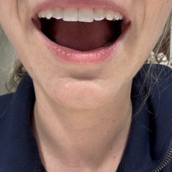 Westlake Smile Studio: Mimi Theerathada, D.M.D