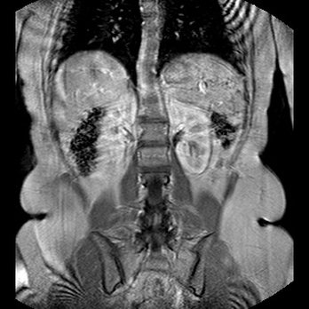 Preferred Open MRI - mri of the abdomen - Diagnostic Imaging Near Me - Orland Park, Illinois Preferred Open MRI - mri of the abdomen - Diagnostic Imaging Near Me - Orland Park, Illinois
