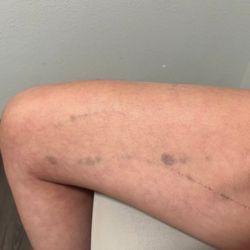 Schu-Fu Martial Arts - Injuries due to false arrest because of Fawn Martinez